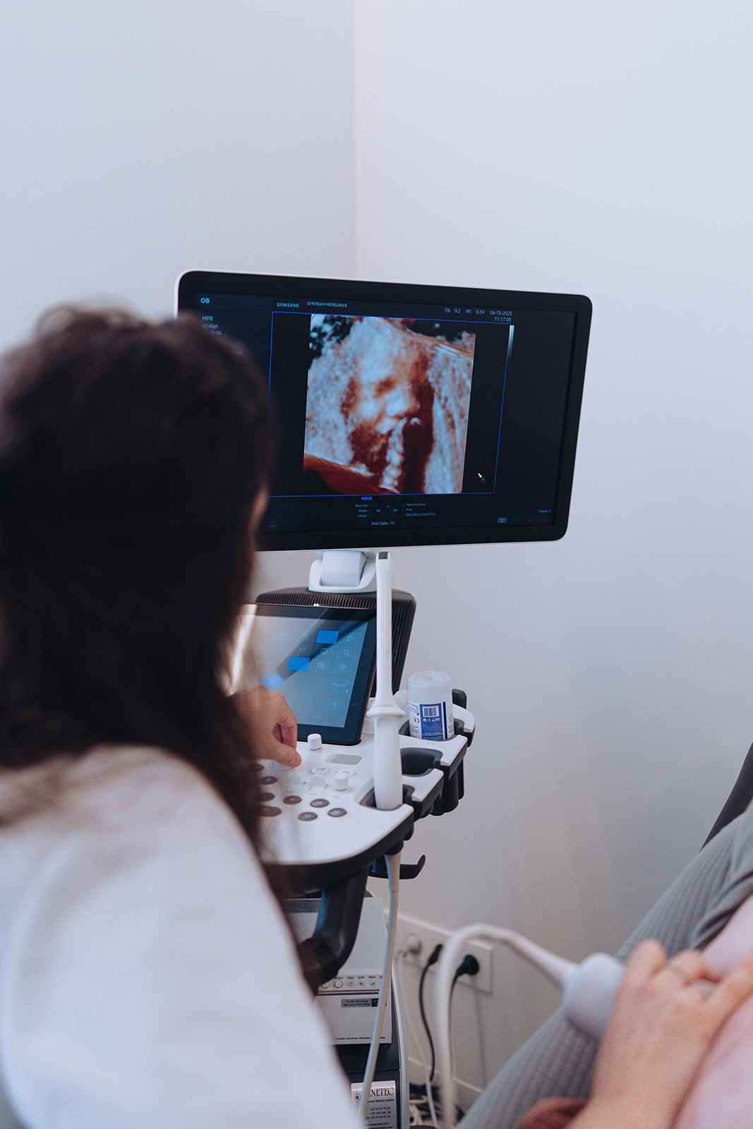 3D-echografie van een baby op het scherm tijdens een echo bij Mom+ Merelbeke